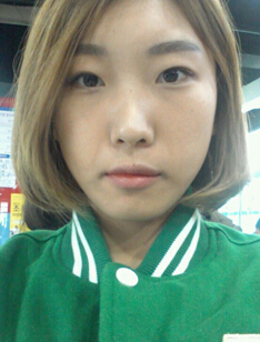 整形前后对比图片