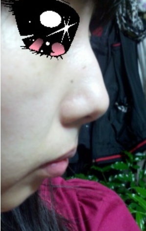 整形前后对比图片