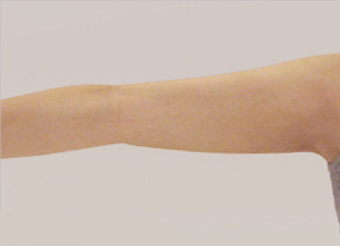 整形前后对比图片