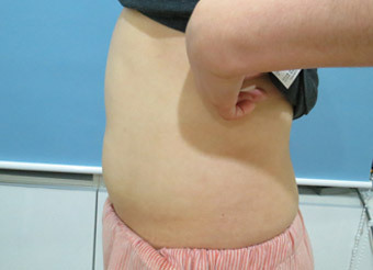 整形前后对比图片