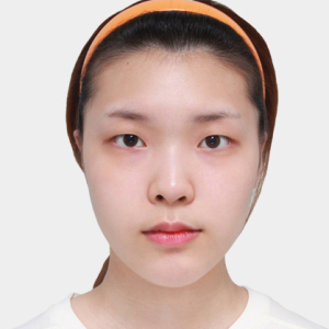 整形前后对比图片