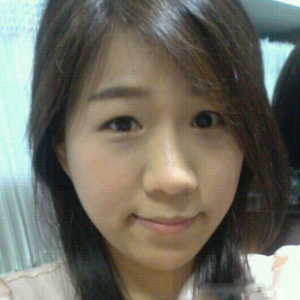 整形前后对比图片