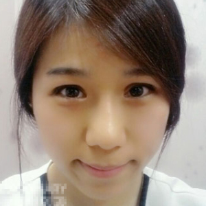 整形前后对比图片