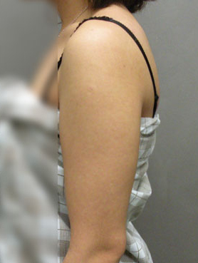 整形前后对比图片