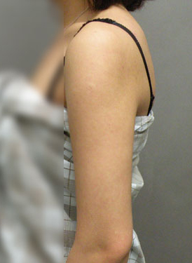 整形前后对比图片