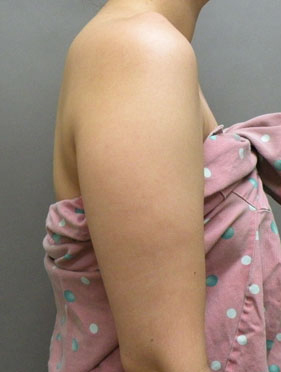 整形前后对比图片