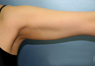 整形前后对比图片