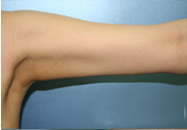 整形前后对比图片