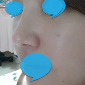 整形前后对比图片