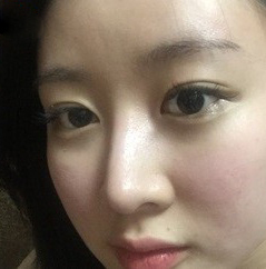 整形前后对比图片