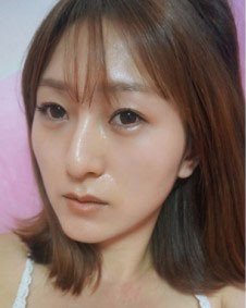 整形前后对比图片