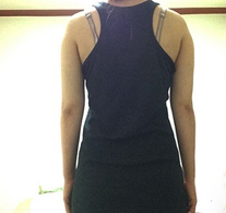 整形前后对比图片