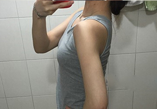 整形前后对比图片