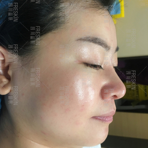 整形前后对比图片