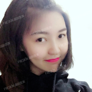 整形前后对比图片