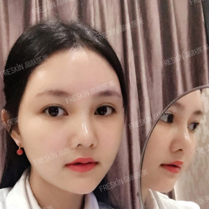 整形前后对比图片