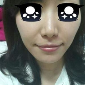 整形前后对比图片