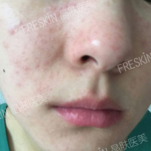 整形前后对比图片