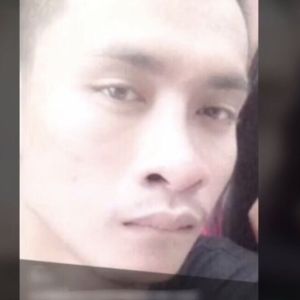 整形前后对比图片