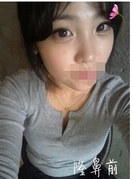 整形前后对比图片