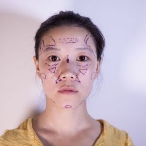 整形前后对比图片