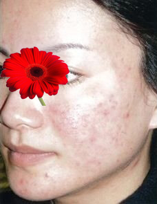 整形前后对比图片