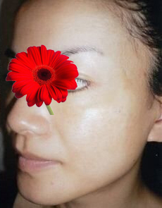 整形前后对比图片