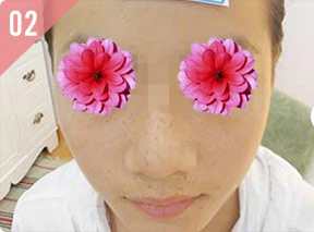 整形前后对比图片