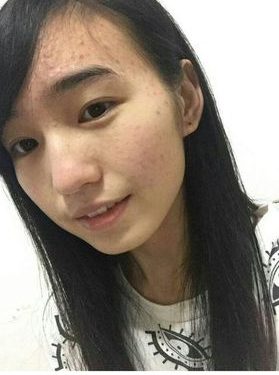 整形前后对比图片