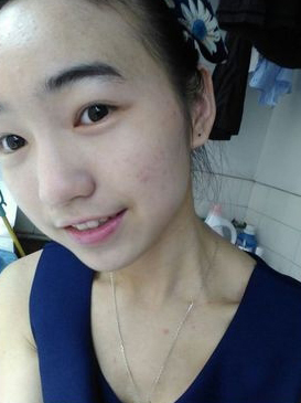 整形前后对比图片