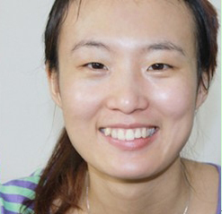 整形前后对比图片