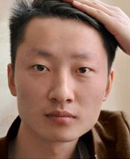 整形前后对比图片