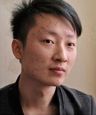 整形前后对比图片