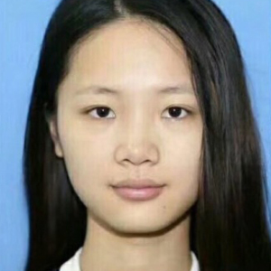 整形前后对比图片