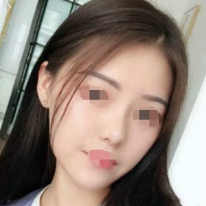 整形前后对比图片