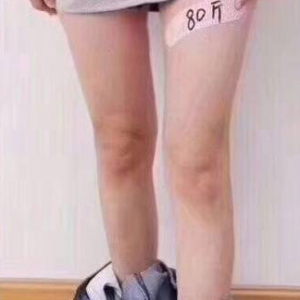 整形前后对比图片