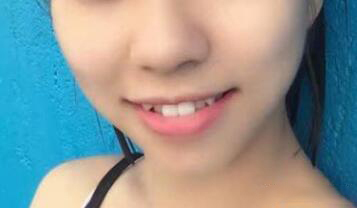 整形前后对比图片