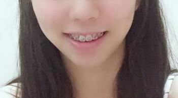 整形前后对比图片