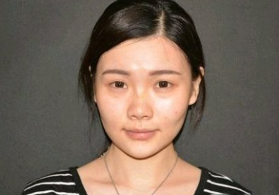 整形前后对比图片