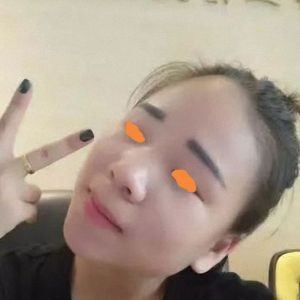 整形前后对比图片