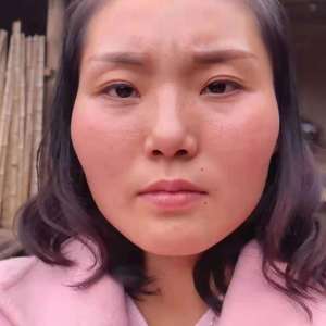 整形前后对比图片