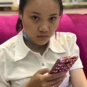 整形前后对比图片