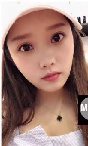 整形前后对比图片