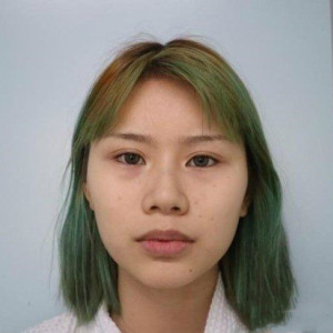 整形前后对比图片