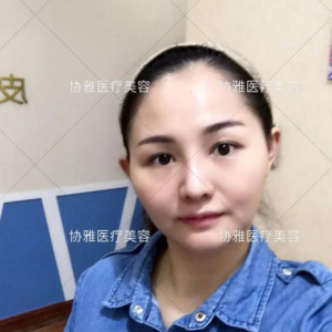 整形前后对比图片