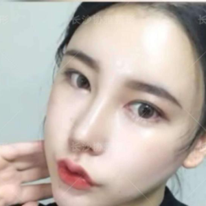 整形前后对比图片