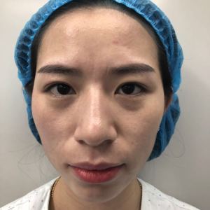 成都臻瑞医疗的日记