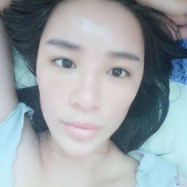 成都臻瑞医疗的整形术后图片