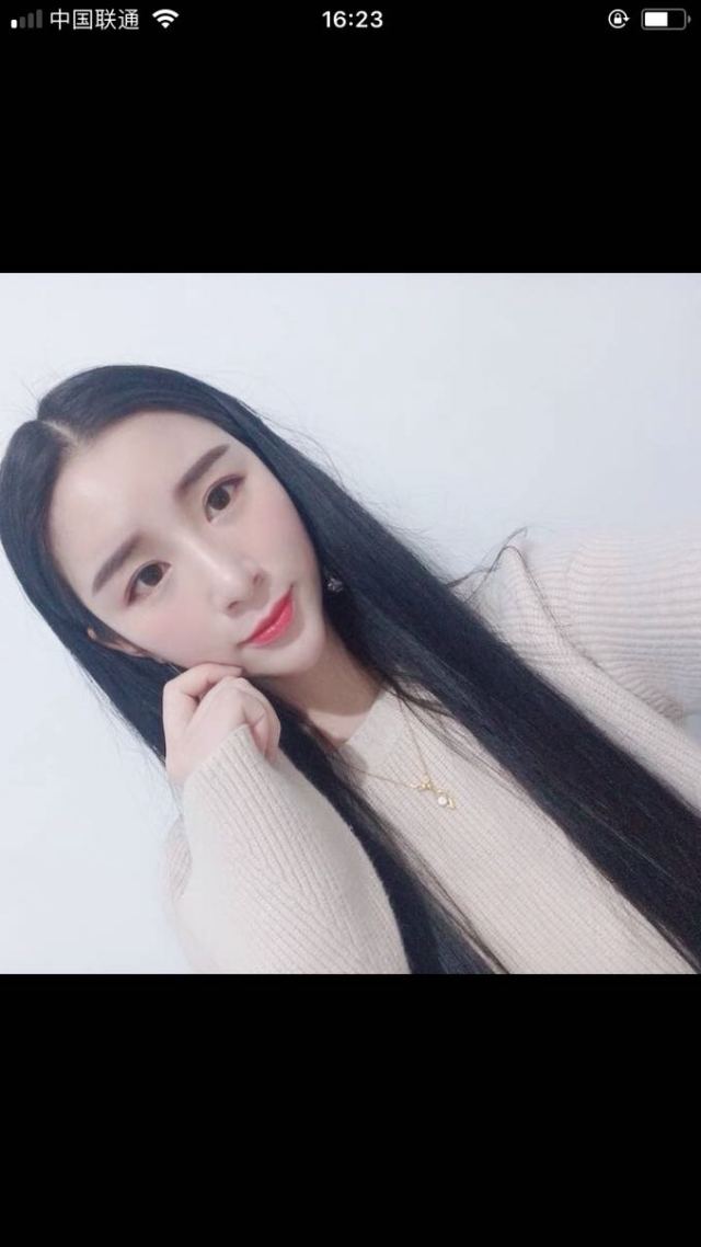 成都臻瑞医疗的整形术后图片