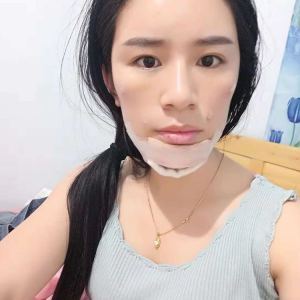 成都臻瑞医疗的整形术后图片